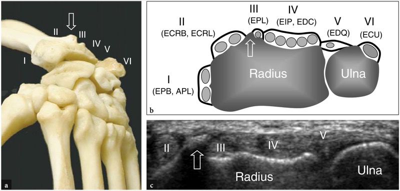 9. Extensor Tendons